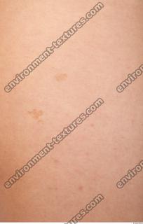 photo texture of white skin 0024